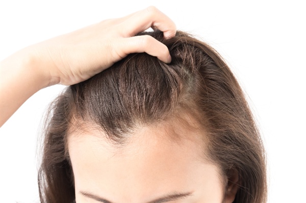 Are You an Ideal Candidate for Hair Transplants? Find Out Here