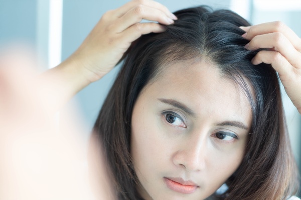 Non-Surgical Hair Loss Solutions in Minneapolis: Effective Treatments Explained