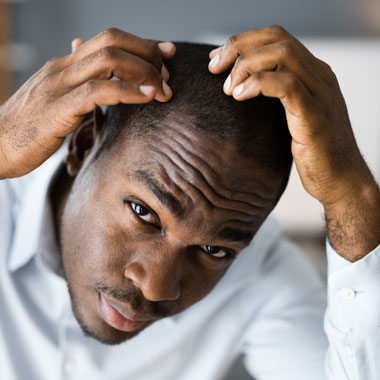 Hair Transplants (FUE)