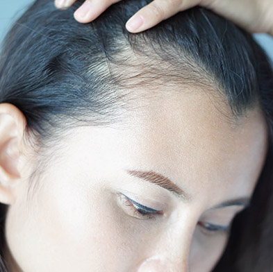Women’s Hair Loss